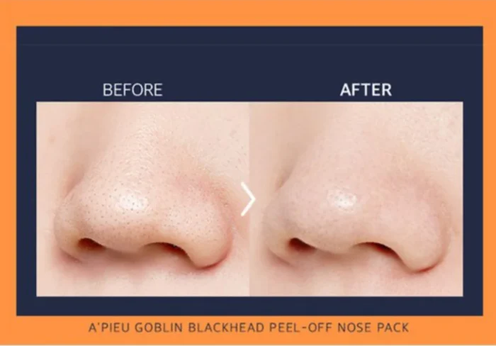 A'PIEU - Goblin Blackhead 3-Step Nose Pack - Imagen 3
