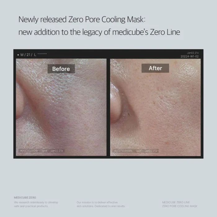 Medicube - Zero Pore Cooling Mask - Imagen 3