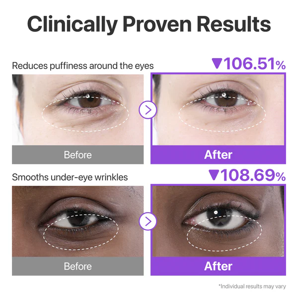 Numbuzin No.9 NAD Collagen Under Eye patches - Imagen 2